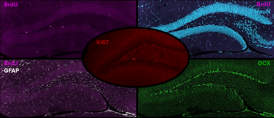 Brain Adaptations Project